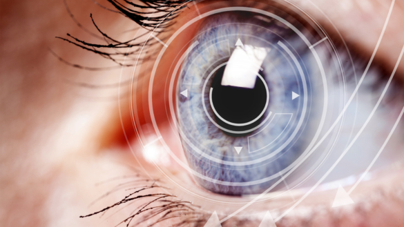 Grå starr (katarakt): orsak, symtom & behandling